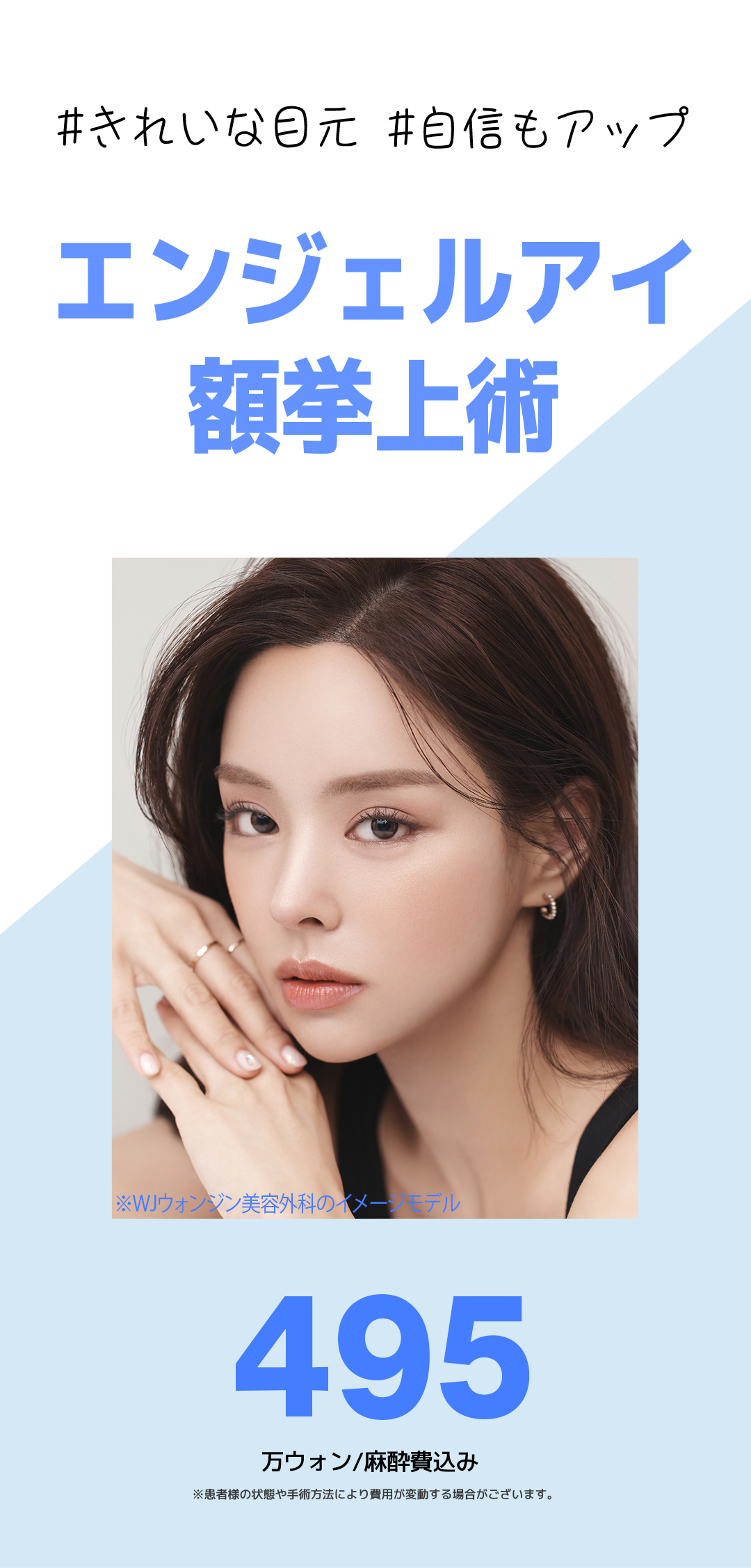 Nâng trán Angel Eye｜Hướng đến cải thiện chảy xệ mí mắt, sụp mày｜Viện thẩm mỹ WJ Wonjin (ga Gangnam)