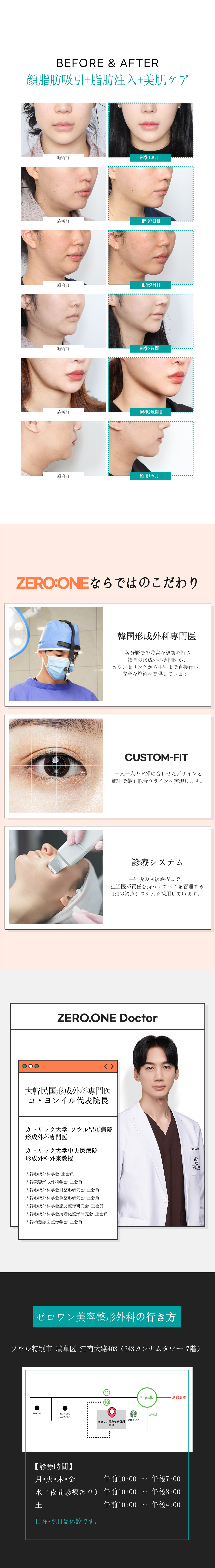 Hút mỡ đường viền mặt + Tiêm mỡ + Chăm sóc da | Chẩn đoán chính xác 3D-CT hướng đến tạo V-line | Zero One Thẩm mỹ Ngoại khoa Gangnam