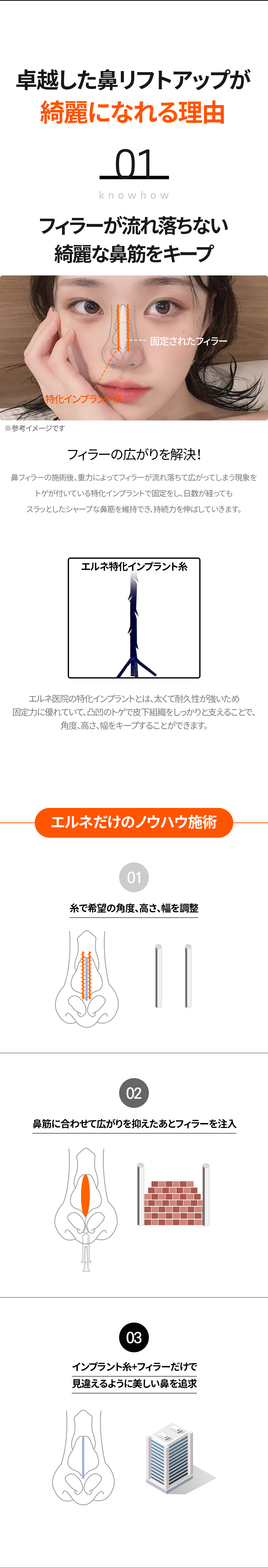 Nâng mũi không dao Nose Thread Lift | Thủ thuật 15 phút giảm downtime | Elne Clinic ga Gangnam, Seoul