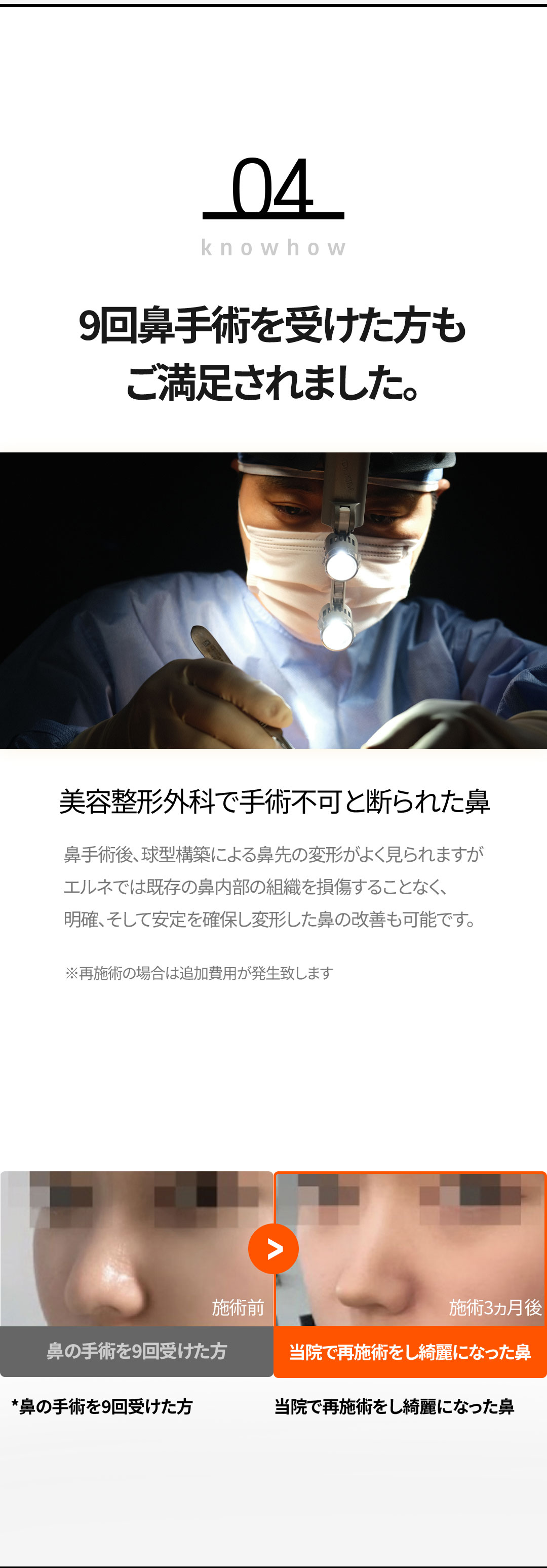 Nâng mũi không dao Nose Thread Lift | Thủ thuật 15 phút giảm downtime | Elne Clinic ga Gangnam, Seoul