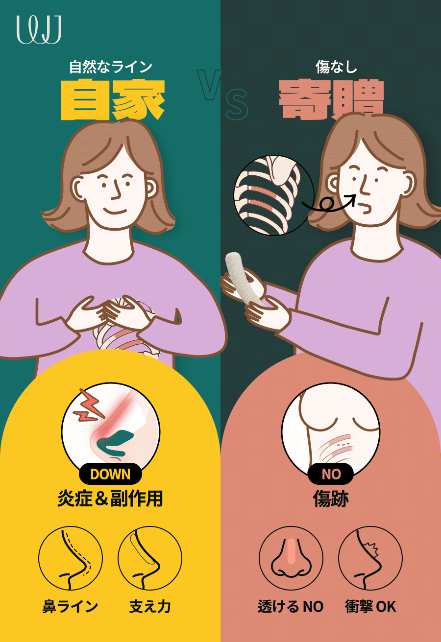 Phẫu thuật mũi sụn sườn tự thân | Thủ thuật hướng tới đường mũi tự nhiên không dùng prosthesis | WJ Wonjin Thẩm mỹ Gangnam