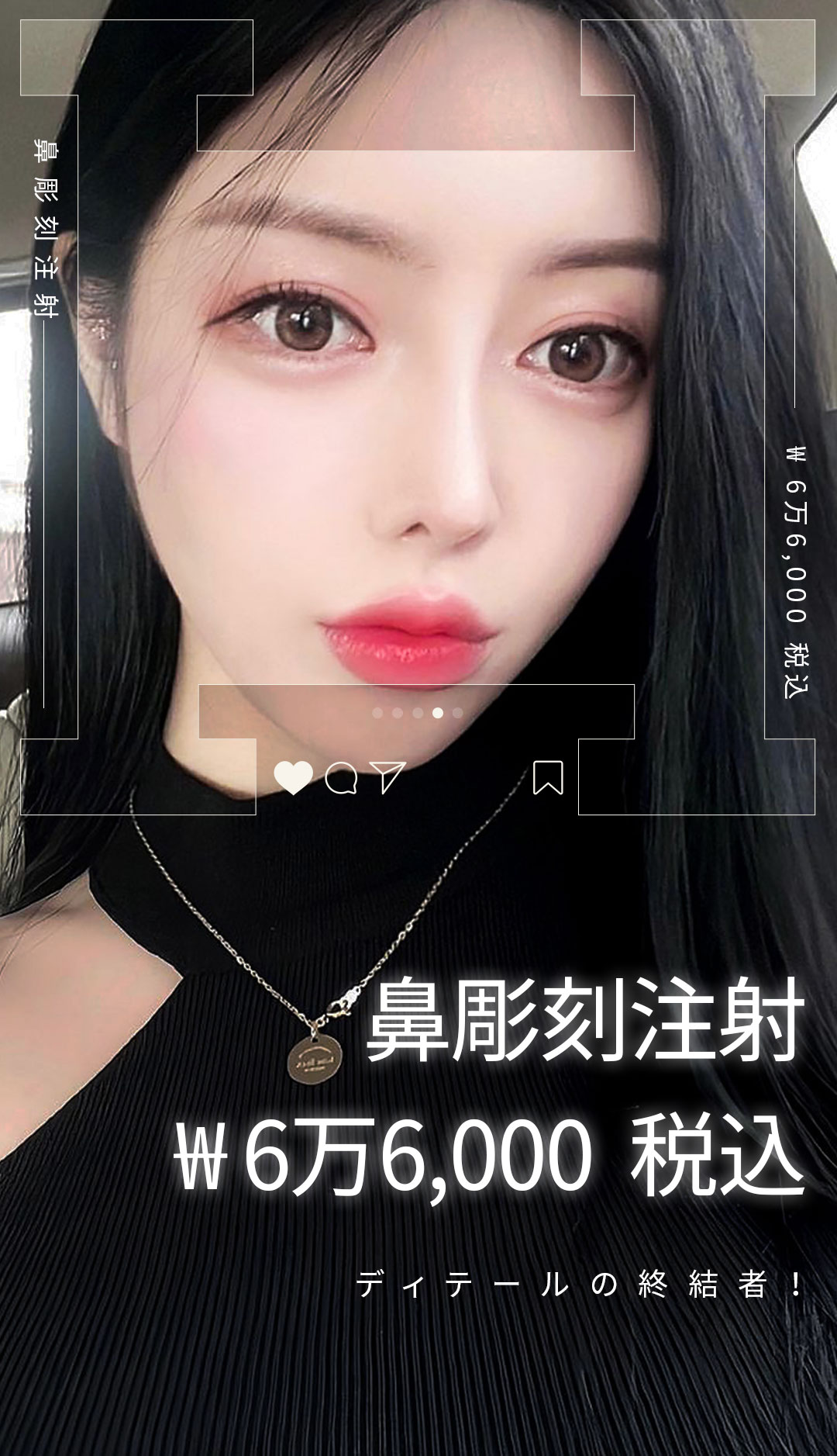 Tiêm điêu khắc mũi để hướng đến đường mũi lý tưởng | Chỉnh mũi không cắt・Phân giải mỡ × Thu nhỏ cơ | Seoul Gangnam stn.・Phòng khám Elne