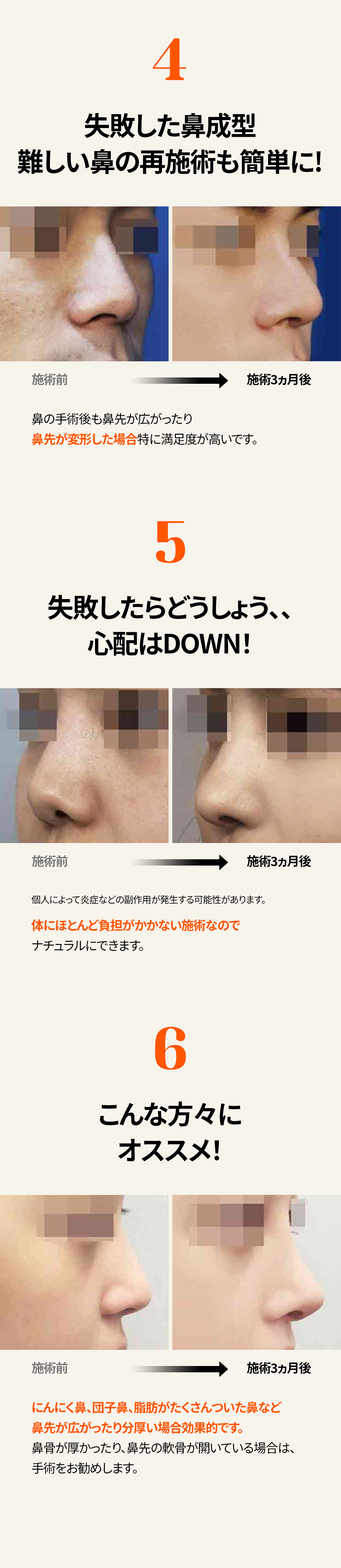 Tiêm điêu khắc mũi để hướng đến đường mũi lý tưởng | Chỉnh mũi không cắt・Phân giải mỡ × Thu nhỏ cơ | Seoul Gangnam stn.・Phòng khám Elne