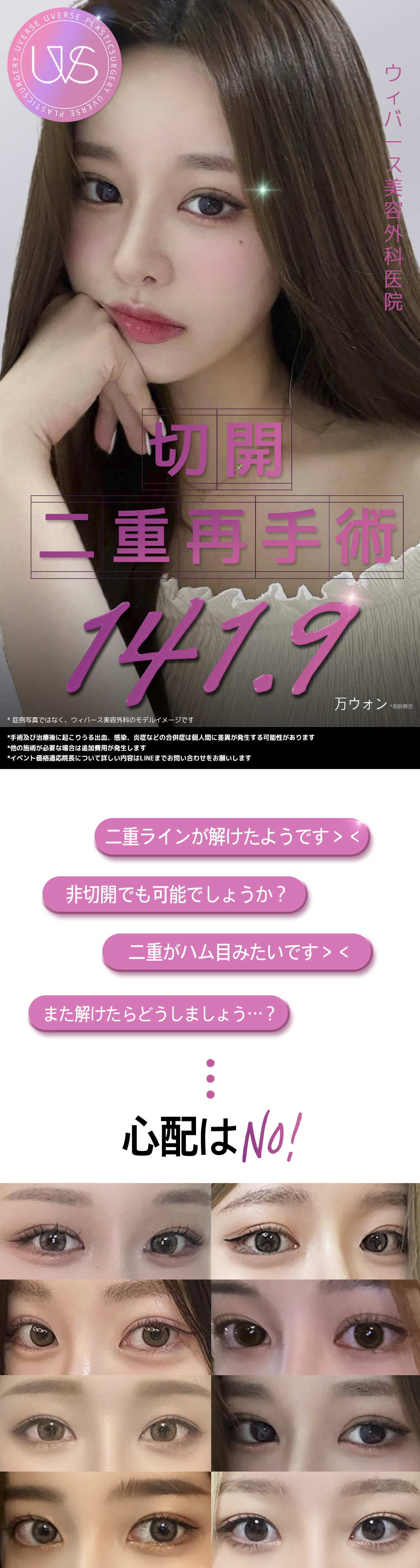 Hướng đến vùng mắt tự nhiên với phẫu thuật lại mí đôi (Phương pháp rạch)｜Điều trị đặt hàng từng người｜Weavers Thẩm mỹ ga Gangnam