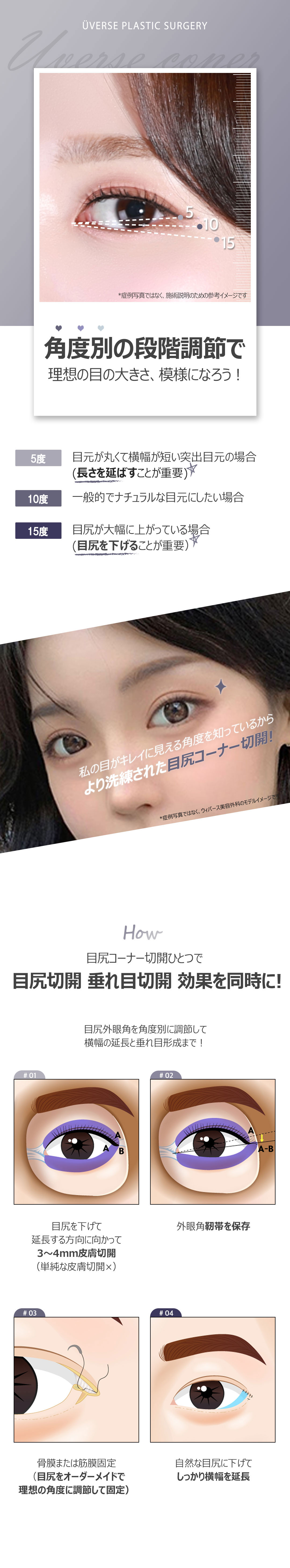 Rạch góc đuôi mắt Weavers