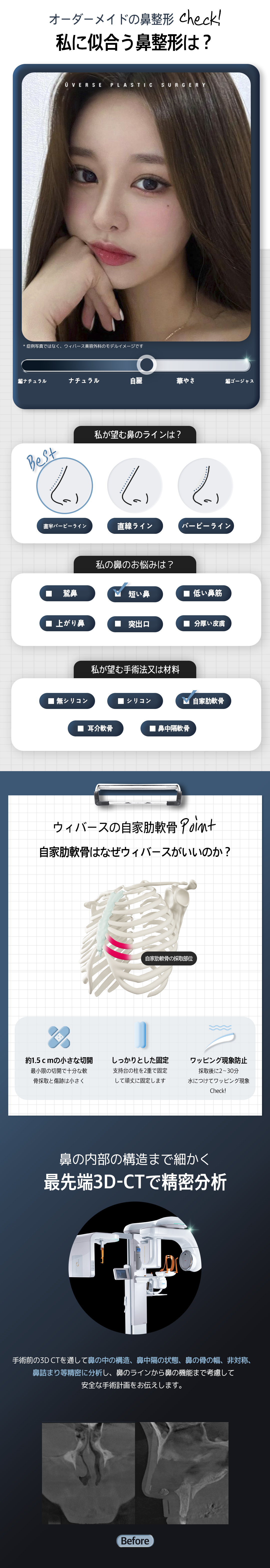 Phẫu thuật mũi sụn sườn tự thân | Thủ thuật đặt hàng riêng với phân tích chính xác 3D-CT | Weavers Thẩm mỹ Gangnam