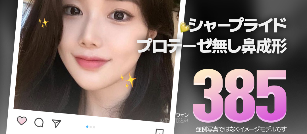 Phẫu thuật mũi không prosthesis | Hướng tới đường mũi tự nhiên bằng mô tự thân | Sharp Thẩm mỹ Sinnonhyeon Seoul