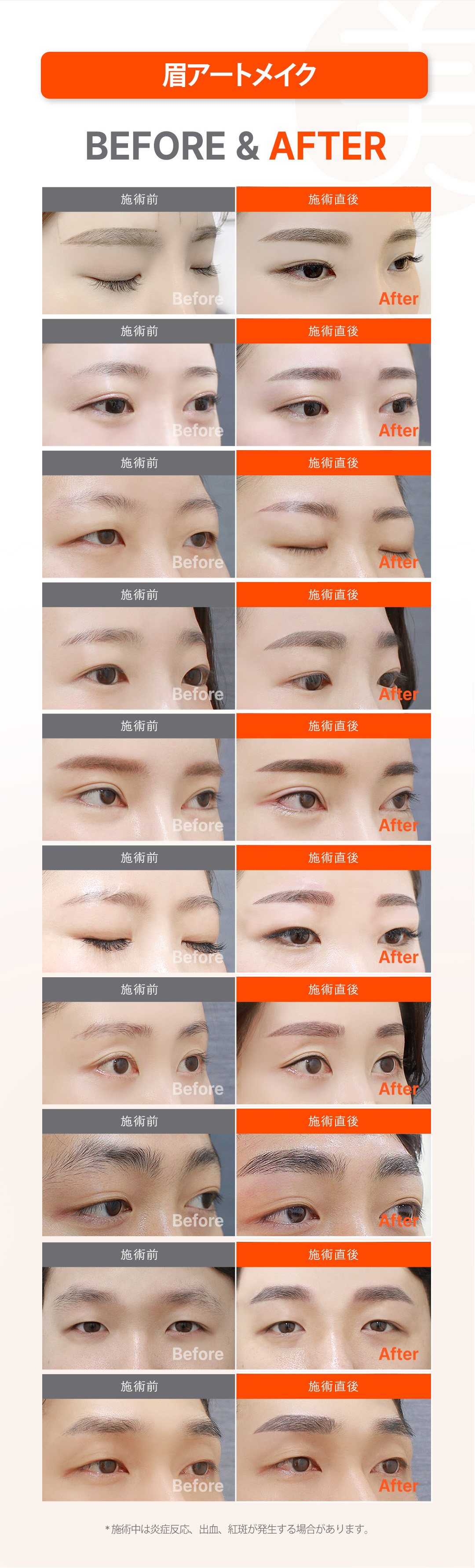 Thủ thuật phun xăm tại Mikei Clinic ga Gangnam, Seoul | Lông mày, eyeliner, môi, đường chân tóc | Thiết kế 1:1 theo yêu cầu