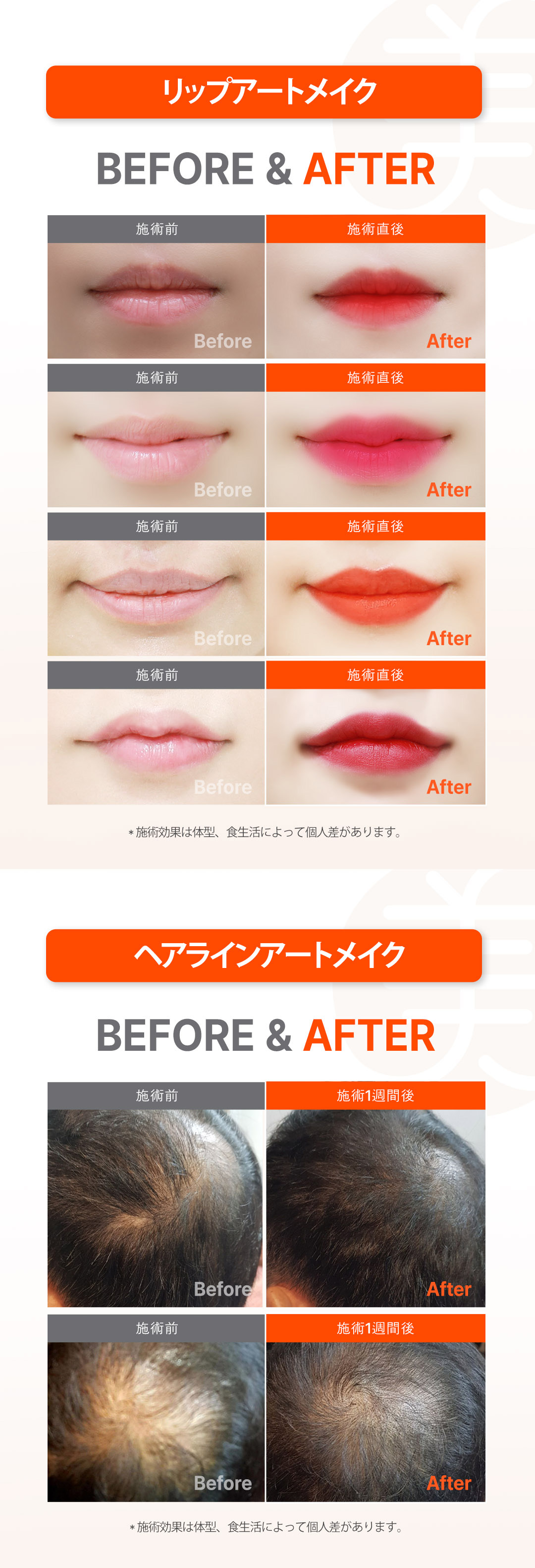 Thủ thuật phun xăm tại Mikei Clinic ga Gangnam, Seoul | Lông mày, eyeliner, môi, đường chân tóc | Thiết kế 1:1 theo yêu cầu