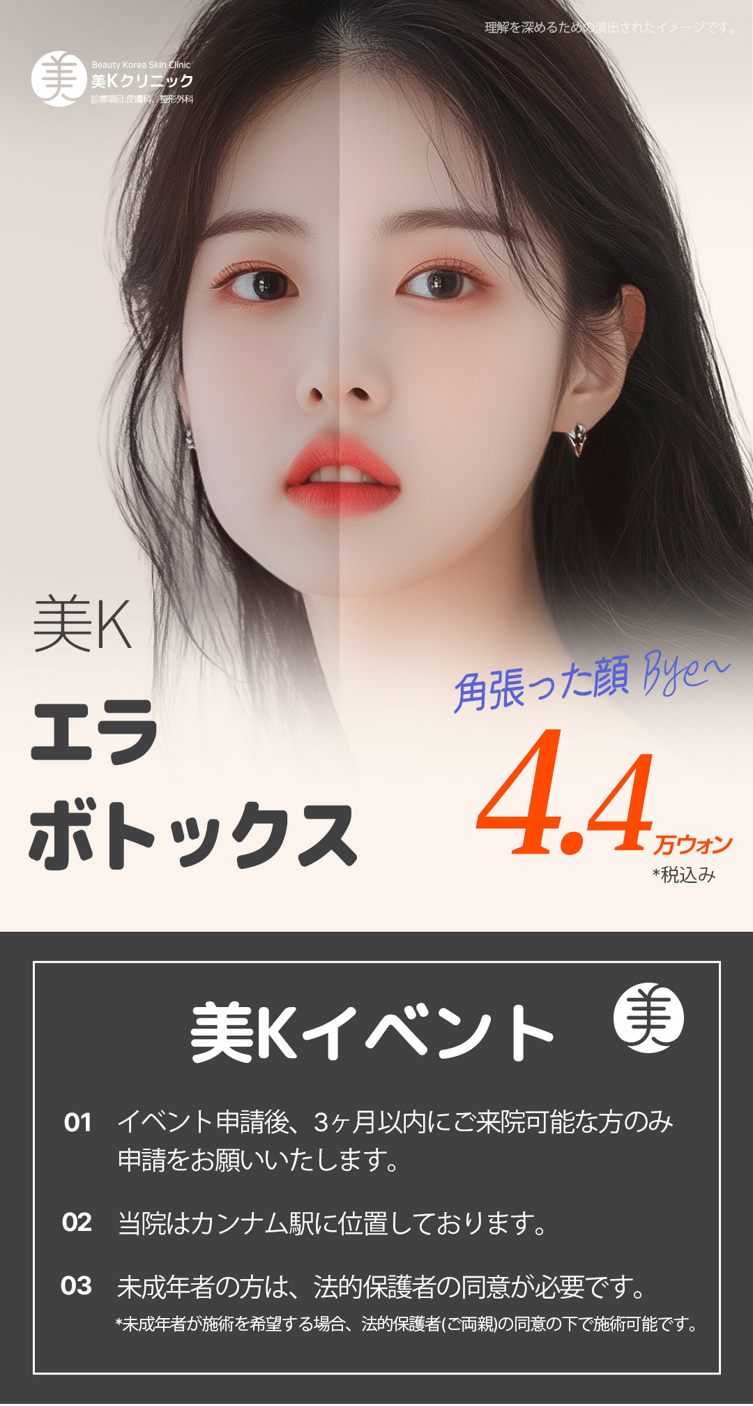 Botox hàm ga Gangnam Hàn Quốc 4.763 yên | Mi K Clinic nhằm tạo V-line tự nhiên