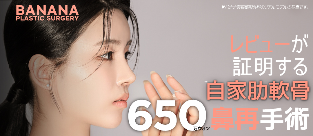 Hướng tới mũi lý tưởng với phẫu thuật lại mũi sụn sườn tự thân | Hỗ trợ xét nghiệm chính xác 3D-CT | Banana Phẫu thuật Tạo hình Thẩm mỹ