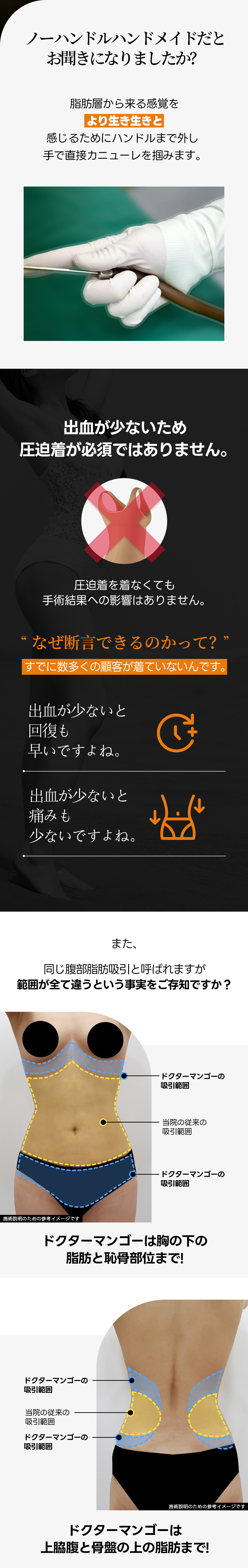 Hàn Quốc Gangnam | Hướng đến đường cong cơ thể mịn màng bằng hút mỡ bụng Handmade | Phòng khám Doctor Mango