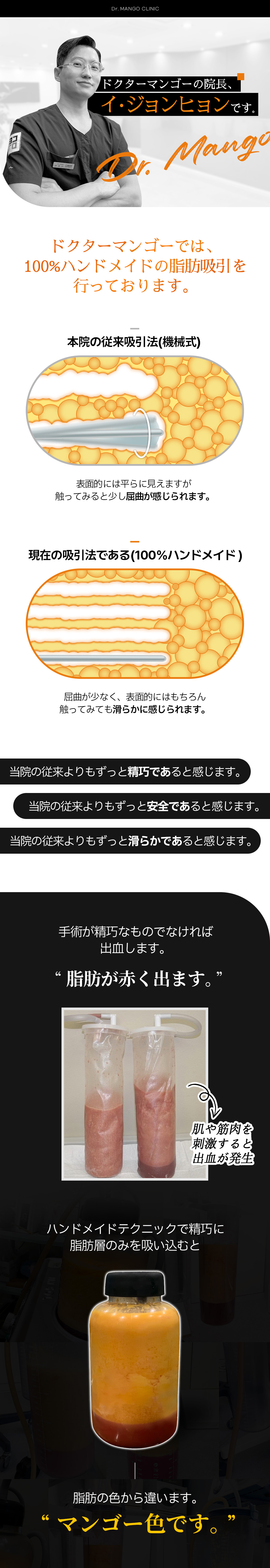 Hàn Quốc Gangnam | Hướng đến đường cong cơ thể mịn màng bằng hút mỡ bụng Handmade | Phòng khám Doctor Mango