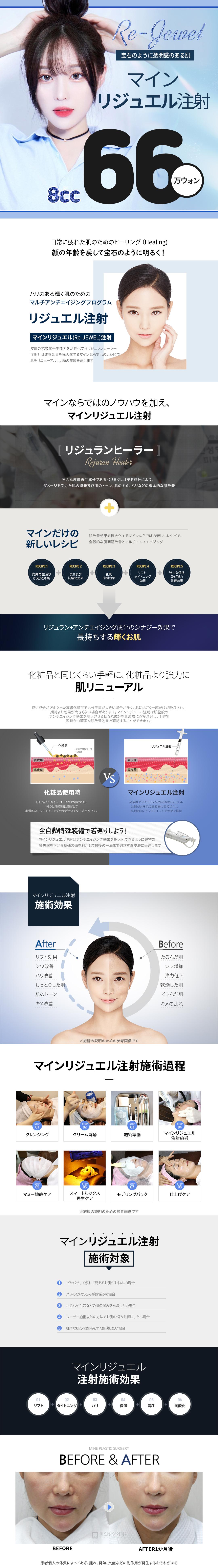 Tiêm Rejuell (Tiêm Water Light) hướng tới làn da đẹp có độ trong suốt và đàn hồi | Thực hiện dung tích lớn 8cc | Phòng khám Mine Thẩm mỹ Ngoại khoa・Ga Apgujeong