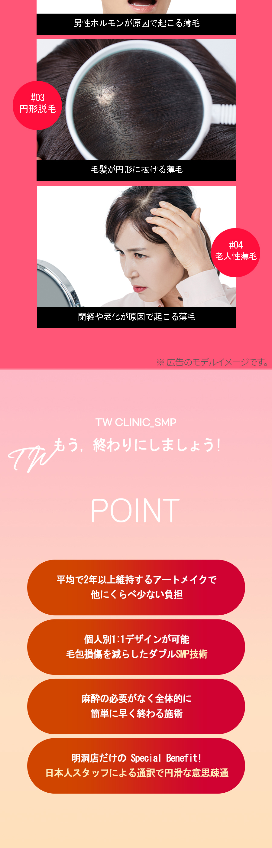 Phun xăm da đầu | Myeongdong Sekaji Sowon Clinic | Điều trị che phủ tóc thưa với nhân viên Nhật thường trực