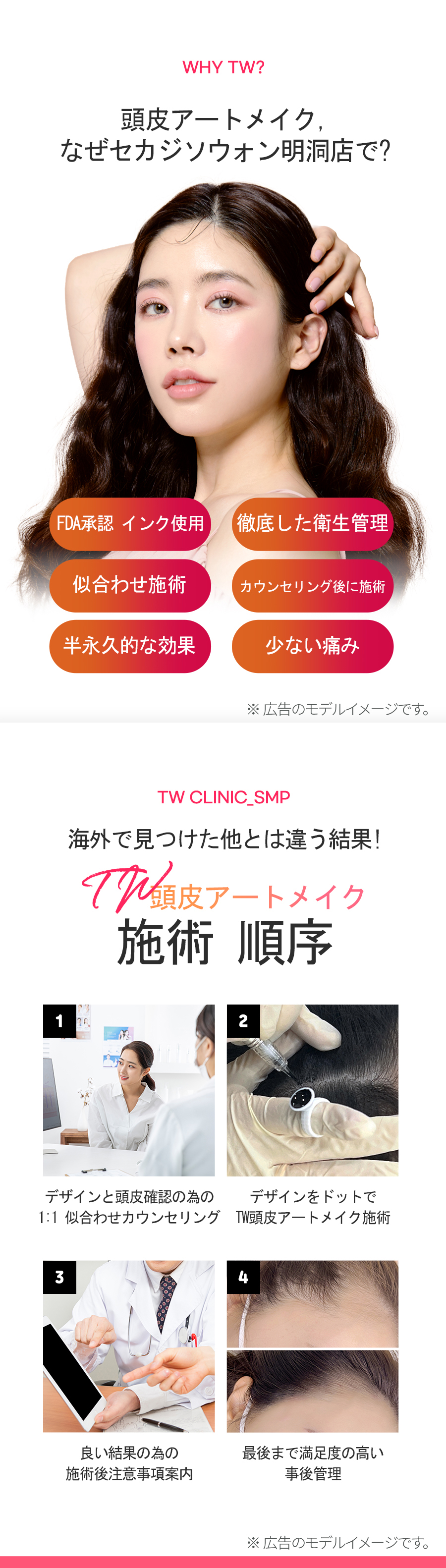 Phun xăm da đầu | Myeongdong Sekaji Sowon Clinic | Điều trị che phủ tóc thưa với nhân viên Nhật thường trực