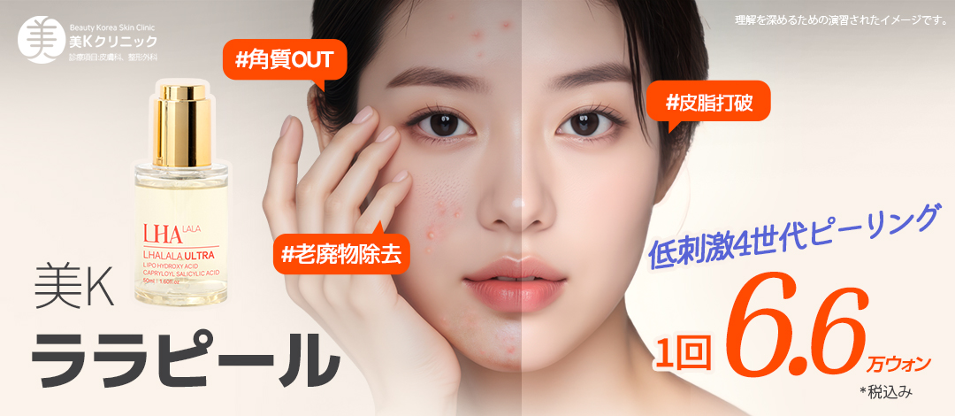 Lara Peel tại Phòng khám MiK Seoul ga Gangnam | Peel thế hệ 4 ít kích ứng để chăm sóc da đẹp