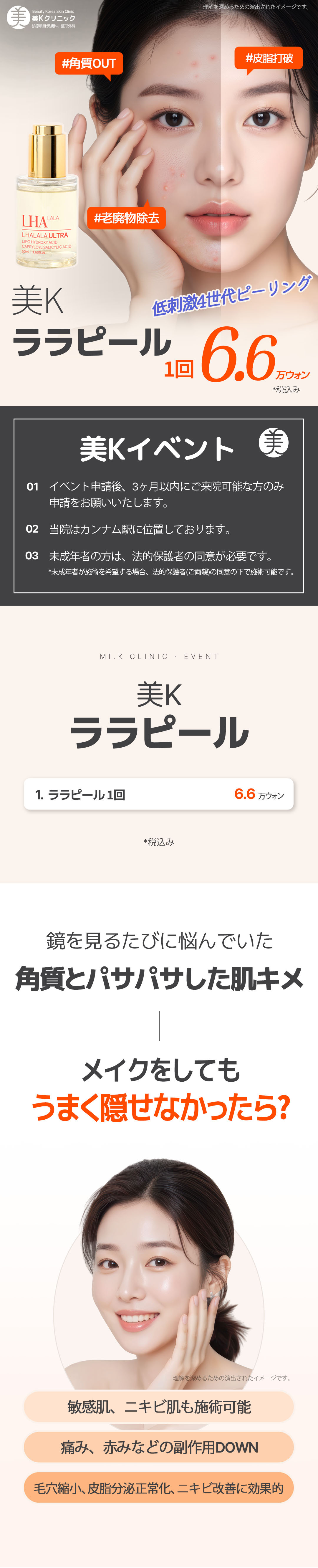 Lara Peel tại Phòng khám MiK Seoul ga Gangnam | Peel thế hệ 4 ít kích ứng để chăm sóc da đẹp