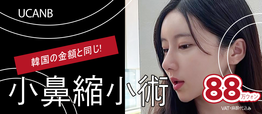 Thu nhỏ cánh mũi | Hướng tới độ bền bằng cố định màng xương | Thủ thuật khoảng 30 phút | U Can Be Phẫu thuật Thẩm mỹ | Hàn Quốc Gangnam