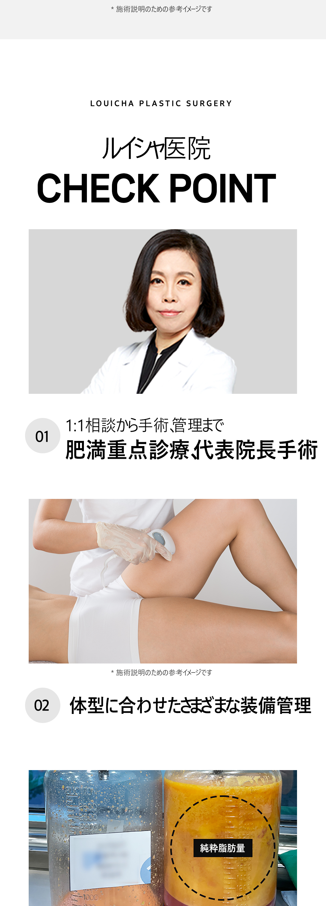 Hút mỡ đùi 360 độ｜Seoul Cheongdam Luixa Clinic｜Thủ thuật dung lượng lớn hướng tới đường viền chân thon gọn