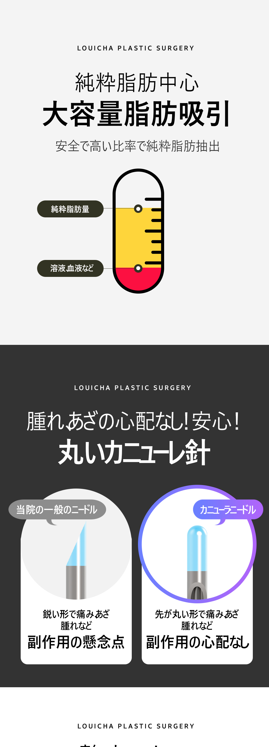 Hút mỡ đùi 360 độ｜Seoul Cheongdam Luixa Clinic｜Thủ thuật dung lượng lớn hướng tới đường viền chân thon gọn