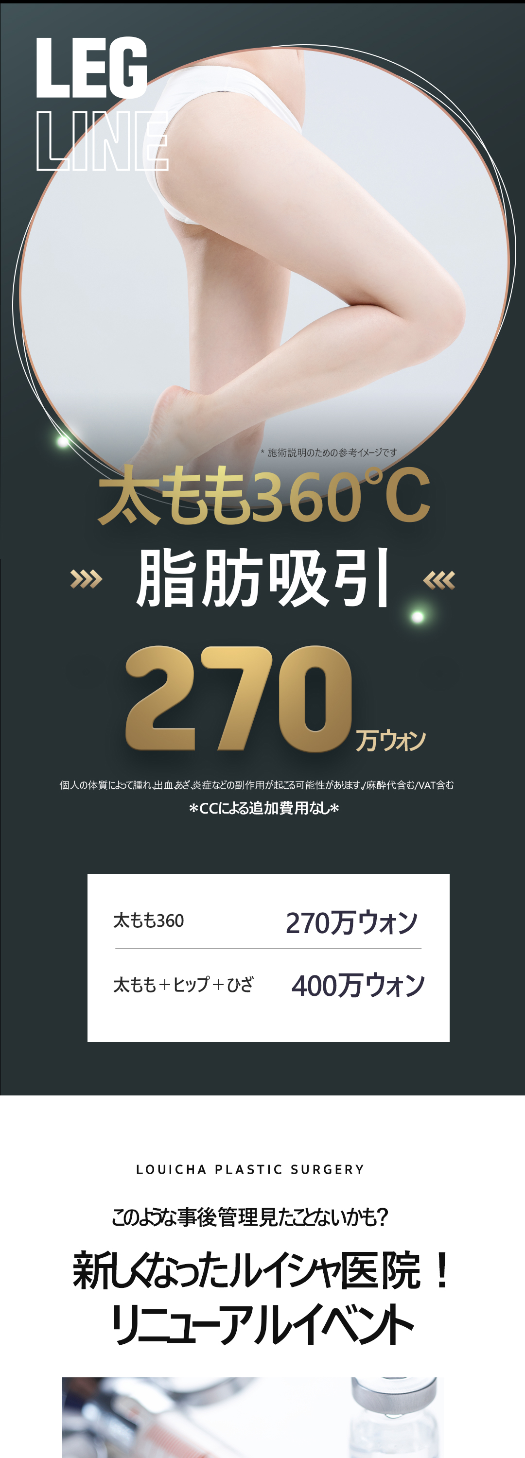 Hút mỡ đùi 360 độ｜Seoul Cheongdam Luixa Clinic｜Thủ thuật dung lượng lớn hướng tới đường viền chân thon gọn