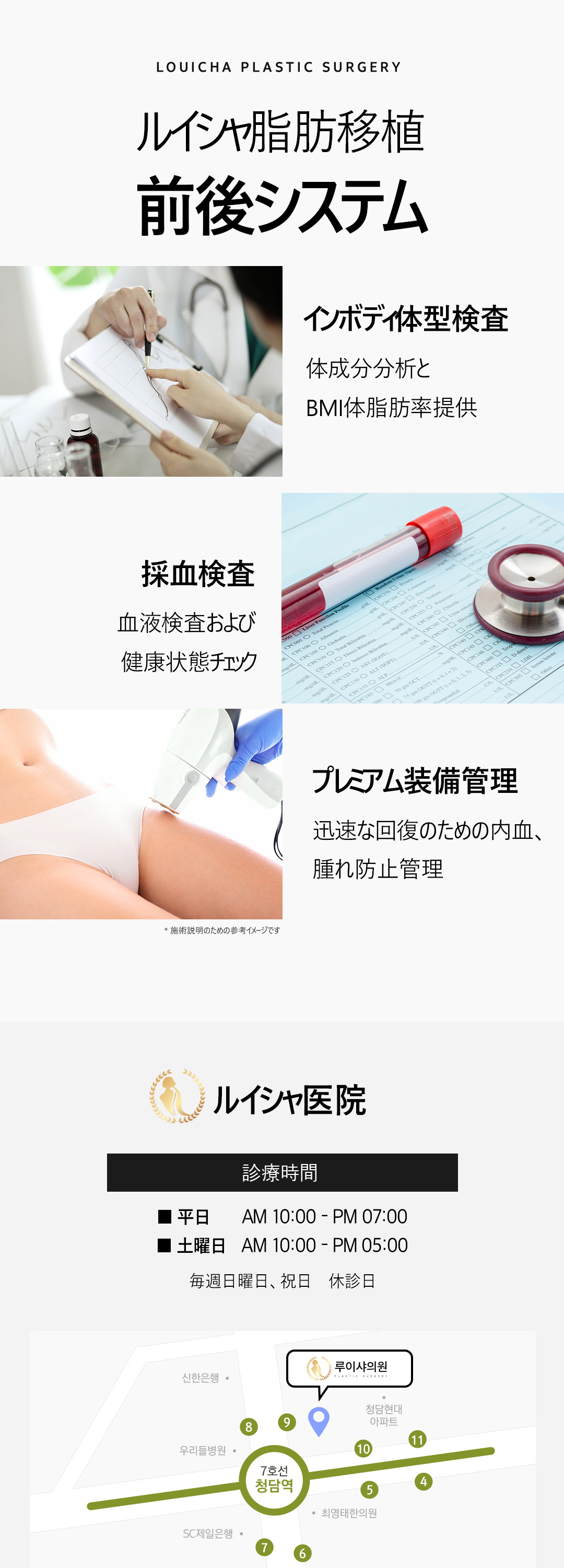 Ghép mỡ mặt + PRP｜Hướng tới volume tự nhiên bằng mỡ tự thân｜Luixa Clinic【Gangnam】