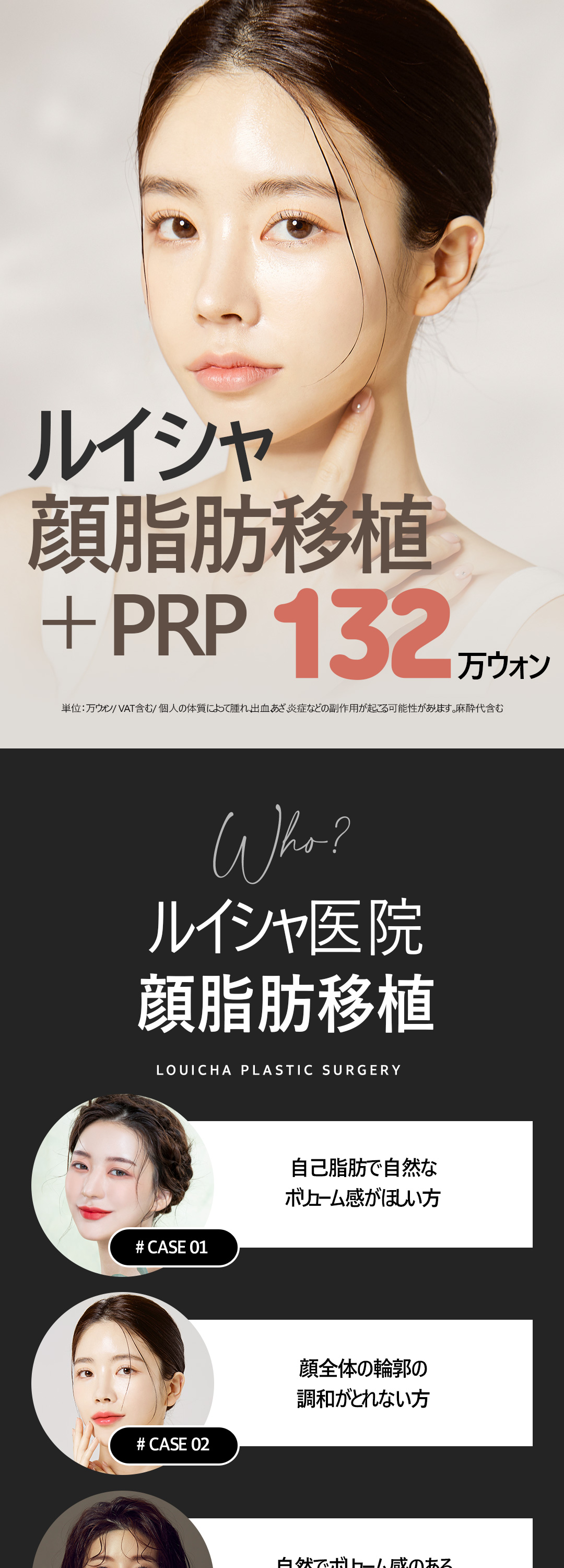 Ghép mỡ mặt + PRP｜Hướng tới volume tự nhiên bằng mỡ tự thân｜Luixa Clinic【Gangnam】