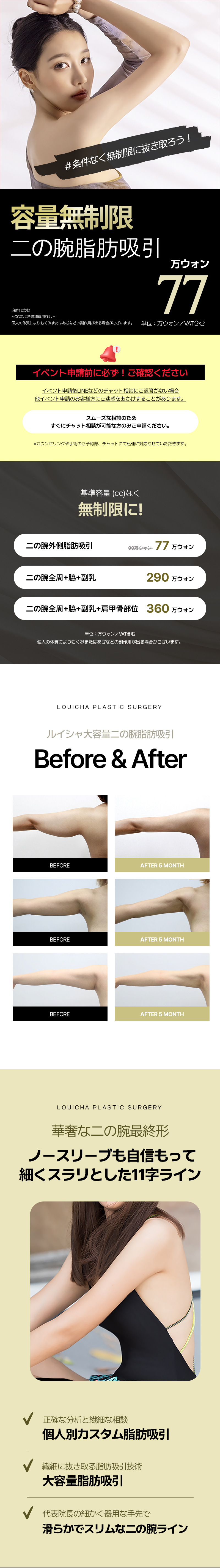 Hút mỡ bắp tay｜Không giới hạn dung tích hướng tới đường viền lý tưởng｜Seoul Cheongdam Luixa