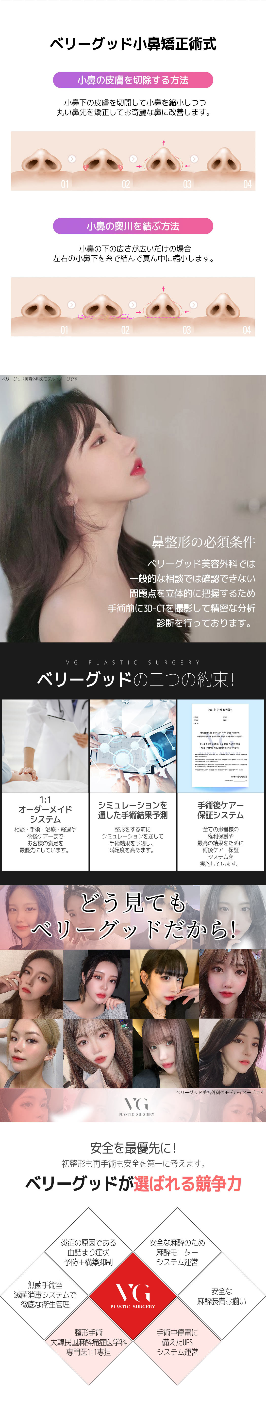 Hướng tới cải thiện mũi tròn với thu nhỏ cánh mũi | Hỗ trợ phân tích chính xác 3D-CT | Berry Good Phẫu thuật Thẩm mỹ ga Gangnam