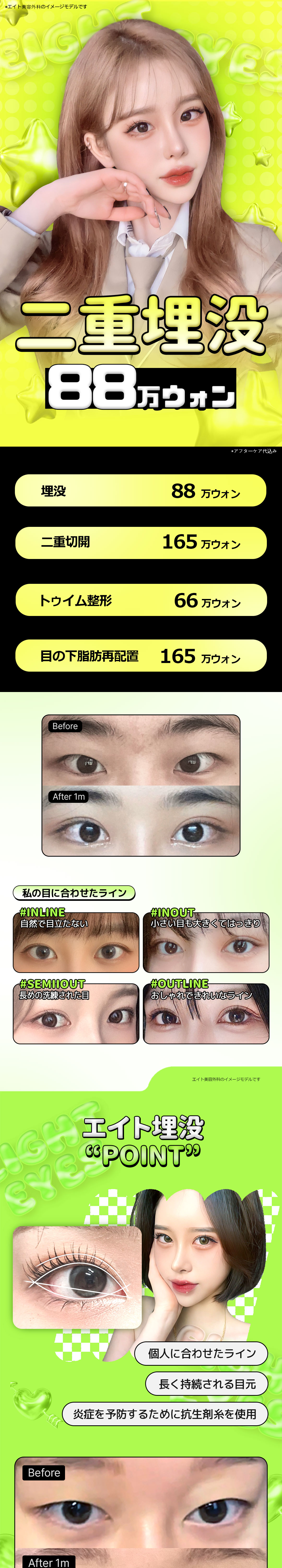 Bấm mí đôi Eight Thẩm mỹ Hàn Quốc | Thủ thuật hướng tới độ bền với kỹ thuật cố định mí đôi độc quyền | Cách ga Apgujeong 5 phút đi bộ