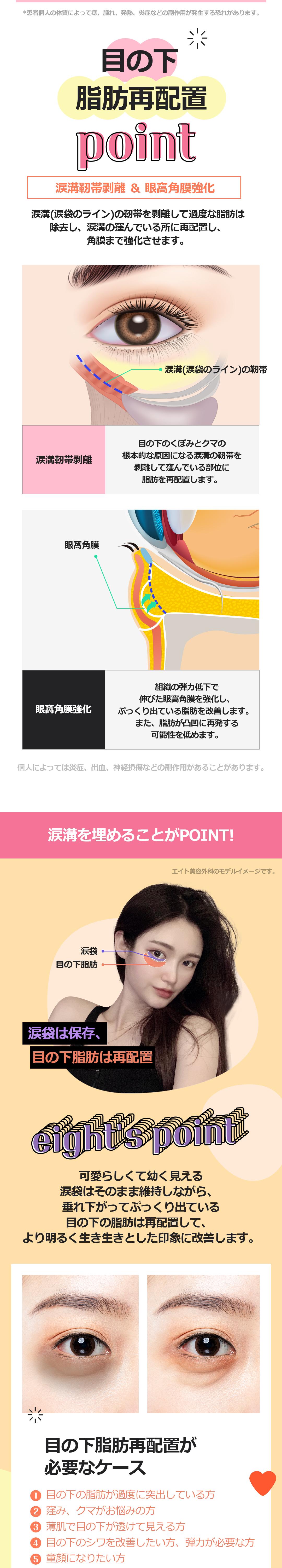 Tái phân bổ mỡ dưới mắt hướng đến vùng mắt tự nhiên | Kỳ vọng cải thiện quầng thâm mà giữ bọng mắt | Eight Thẩm mỹ Ngoại khoa