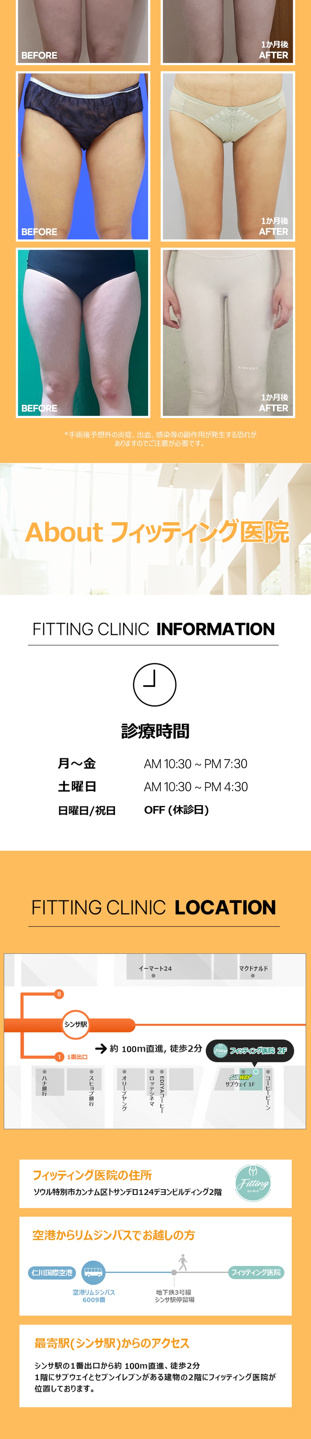 Hút mỡ đùi và trên đầu gối Hàn Quốc | Fitting | Phân tích InBody và chẩn đoán cá nhân tạo đường cong lý tưởng