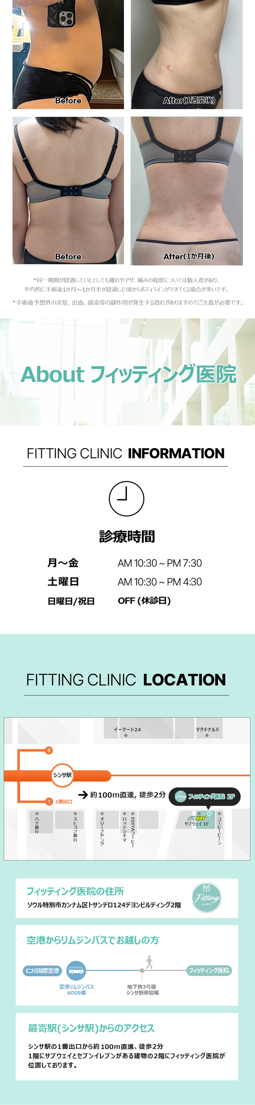 Hút mỡ bắp tay, bụng | Nhằm đường nét cơ thể lý tưởng với phân tích InBody | Fitting Clinic ga Sinsa, Seoul
