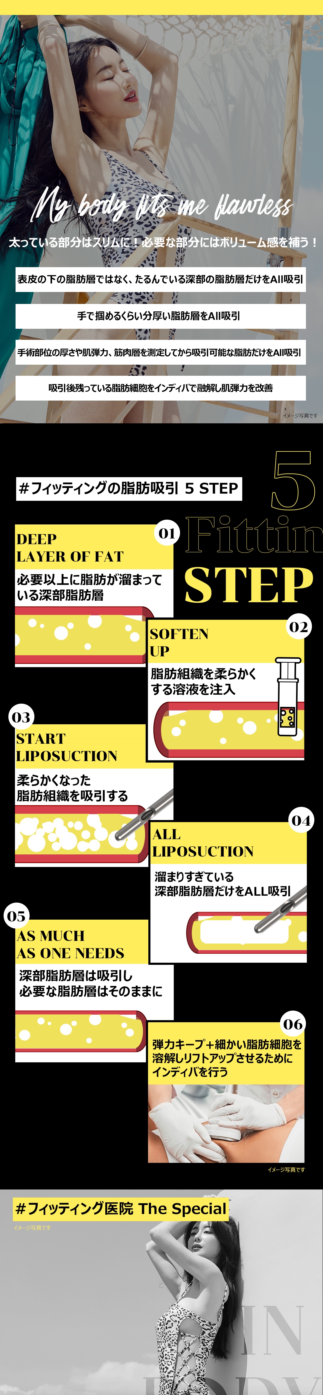 Hút mỡ dung lượng lớn tại Fitting Clinic | Nhằm đường nét cơ thể bằng phân tích InBody x loại bỏ mỡ sâu | Ga Sinsa, Seoul
