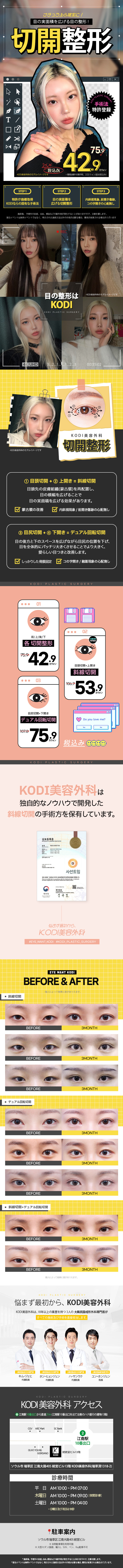 Rạch đường chéo KODI Thẩm mỹ｜Chỉnh hình vùng mắt đạt bằng sáng chế mở rộng diện tích thực mắt tự nhiên｜Seoul ga Gangnam