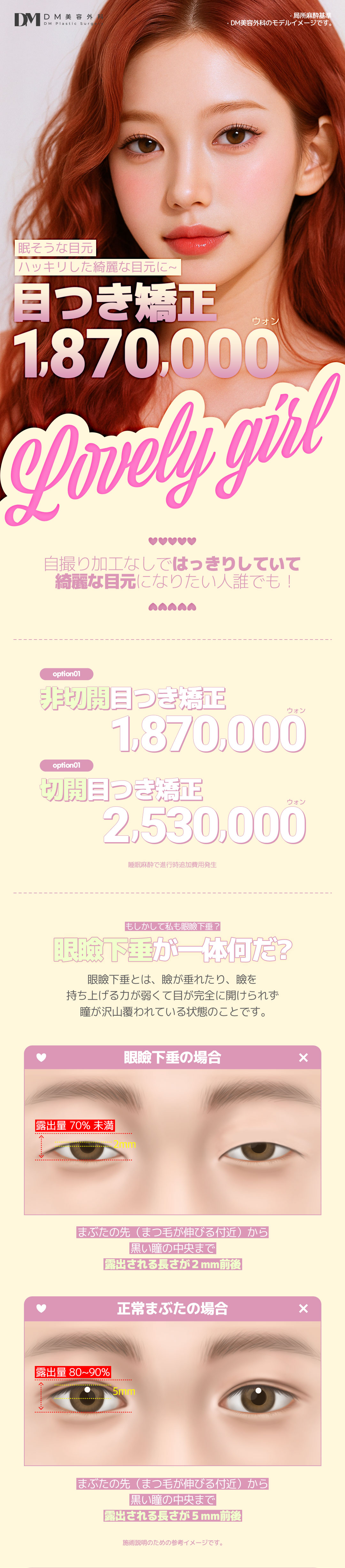 Hướng tới đôi mắt có ấn tượng sáng với Chỉnh ánh mắt (Cải thiện sụp mí) | Có thể chọn cắt・không cắt | Phòng khám DM Thẩm mỹ