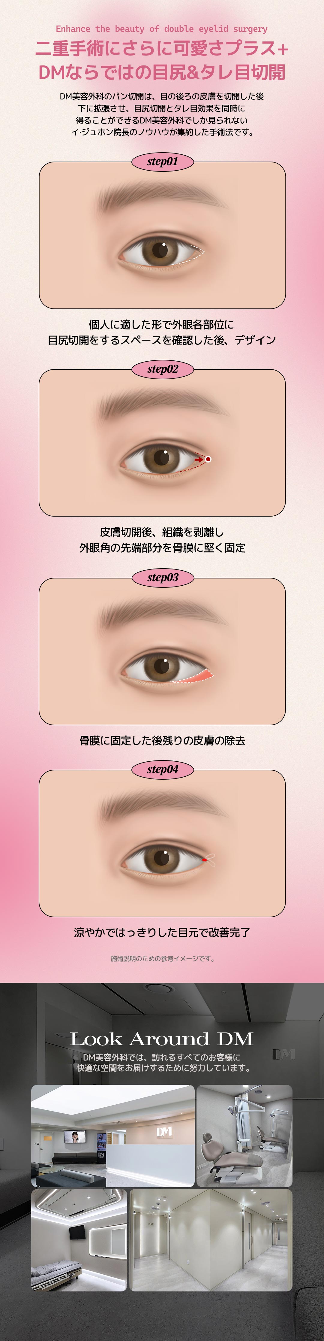 【Phẫu thuật mí đôi Hàn Quốc】Bấm mí・Cắt mí DM Thẩm mỹ | Phẫu thuật mí đôi đặt hàng riêng do viện trưởng đại diện thực hiện | Cách ga Apgujeong 3 phút đi bộ