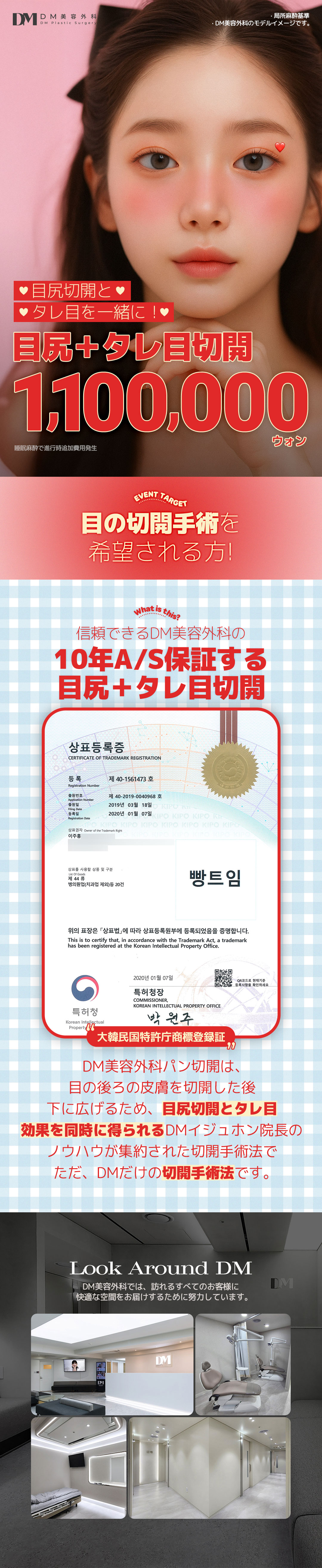 Cắt đuôi mắt tạo mắt cụp | Hướng tới tạo hình mắt tự nhiên | DM Thẩm mỹ Apgujeong Seoul