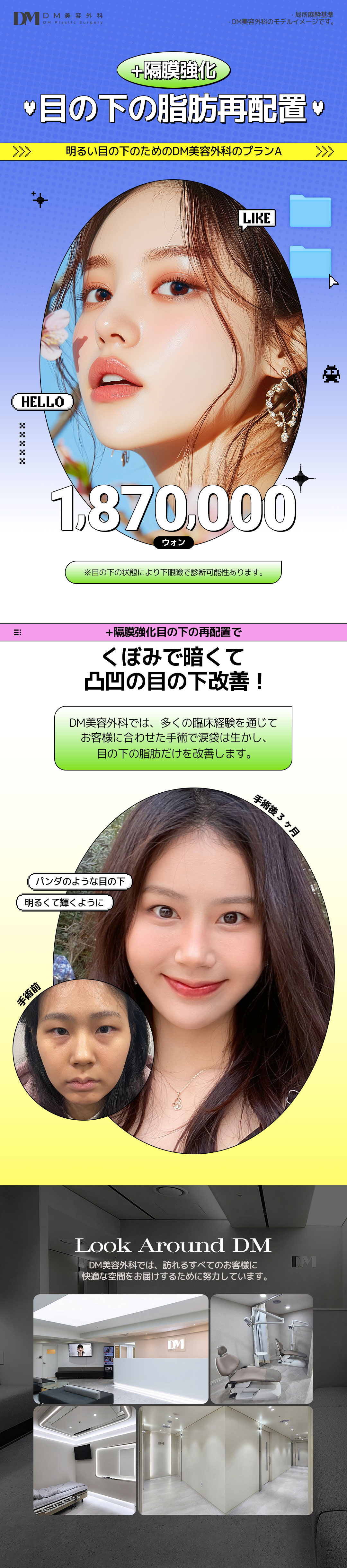 Tái định vị mỡ dưới mắt + Tăng cường vách ngăn cho đôi mắt sáng | DM Plastic Surgery giữ túi mắt | 3 phút đi bộ từ ga Apgujeong