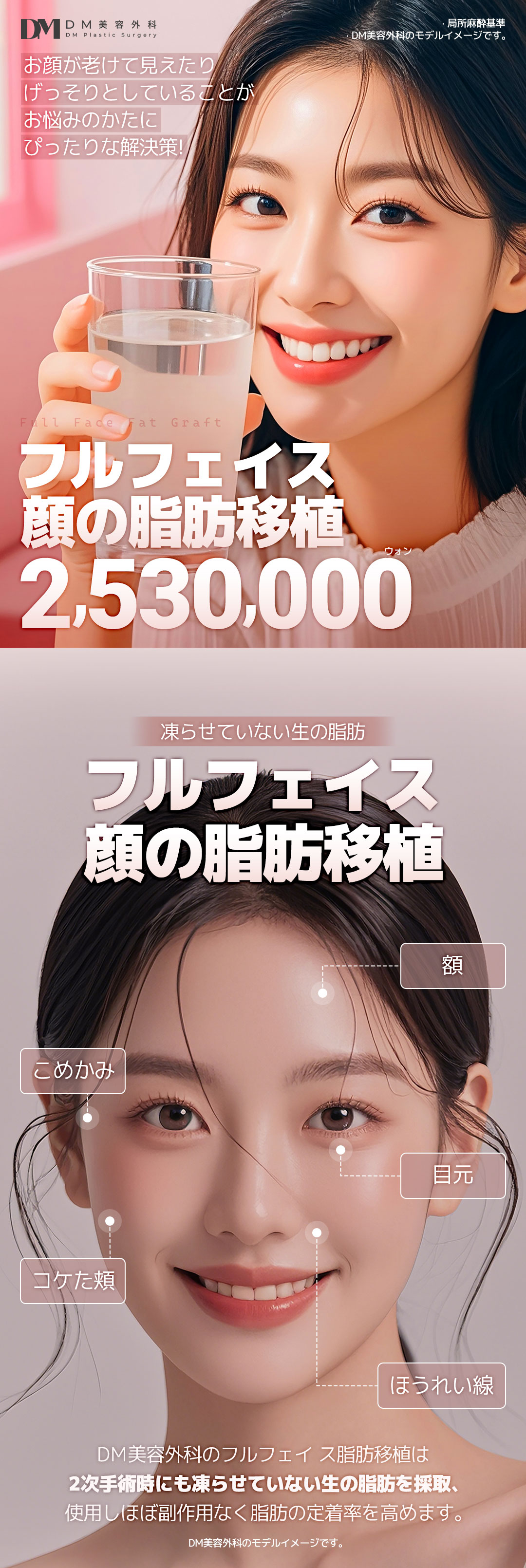 Ghép mỡ toàn mặt｜Tăng volume tự nhiên bằng mỡ tươi｜Seoul Apgujeong DM Plastic Surgery