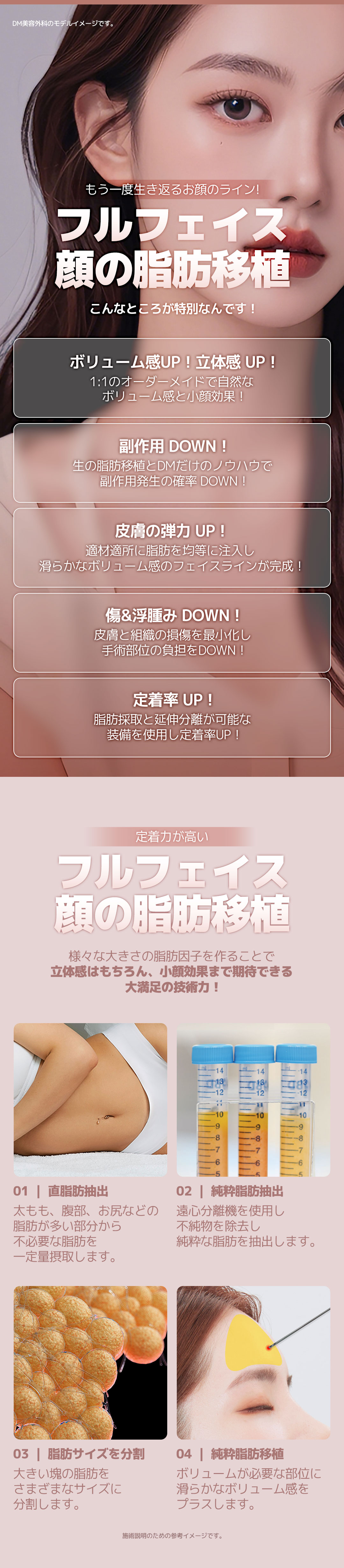 Ghép mỡ toàn mặt｜Tăng volume tự nhiên bằng mỡ tươi｜Seoul Apgujeong DM Plastic Surgery