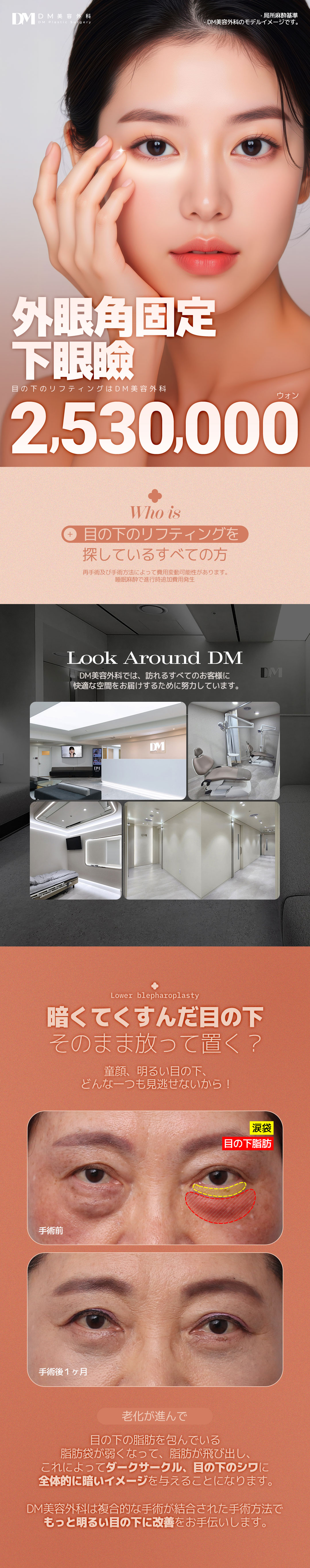 Hướng tới cải thiện chảy xệ・xỉn màu dưới mắt với Phẫu thuật mí dưới cố định góc mắt ngoài | Thẩm mỹ Hàn Quốc DM Thẩm mỹ Apgujeong