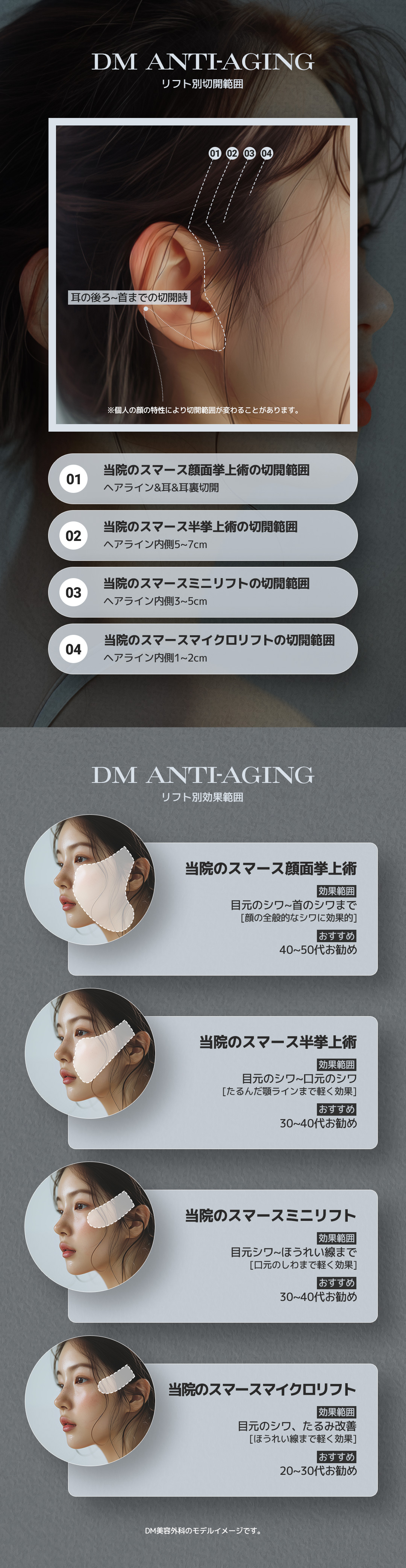 SMAS Semi Lift | Rạch bên trong đường chân tóc giảm sẹo căng da mặt | DM Clinic Apgujeong Seoul