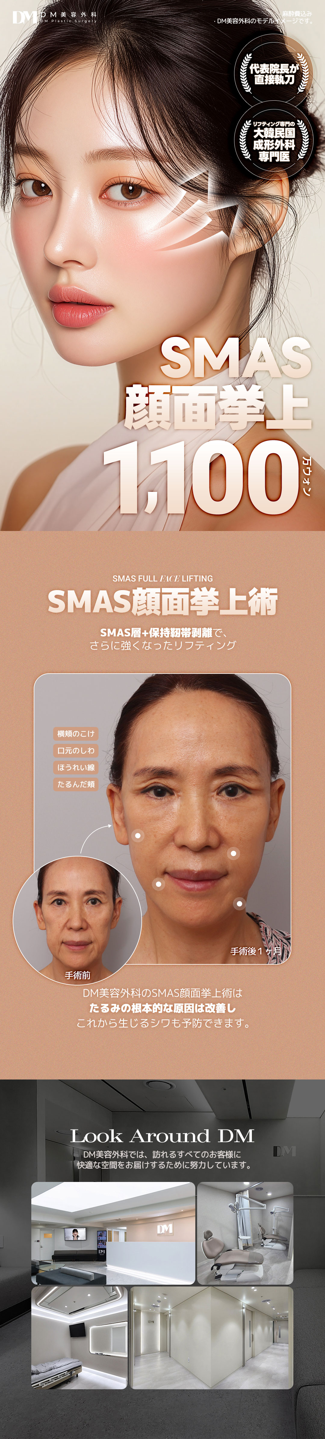 SMAS Face Lift | Phẫu thuật căng da mặt chính thống bởi bác sĩ chuyên khoa | DM Clinic (Apgujeong)