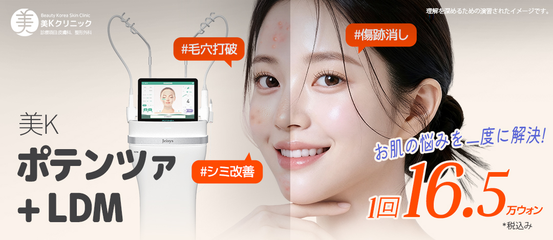 Điều trị lỗ chân lông, sẹo mụn, nám bằng Potenza tại Hàn Quốc Gangnam | Liệu pháp RF vi kim | Phòng khám MiK