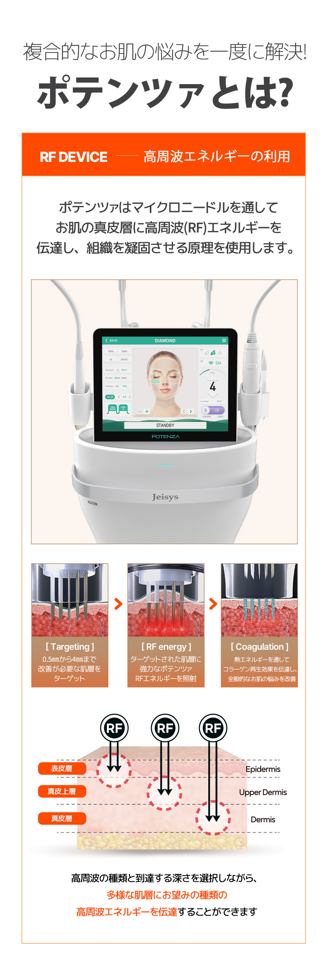Điều trị lỗ chân lông, sẹo mụn, nám bằng Potenza tại Hàn Quốc Gangnam | Liệu pháp RF vi kim | Phòng khám MiK