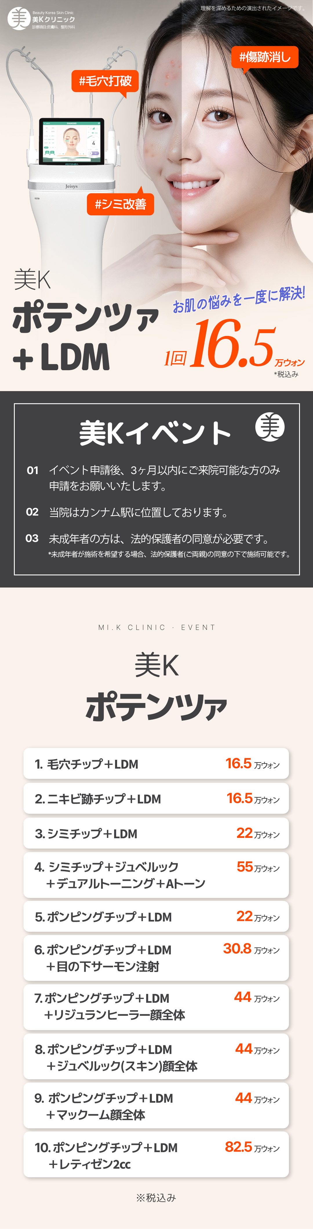 Điều trị lỗ chân lông, sẹo mụn, nám bằng Potenza tại Hàn Quốc Gangnam | Liệu pháp RF vi kim | Phòng khám MiK