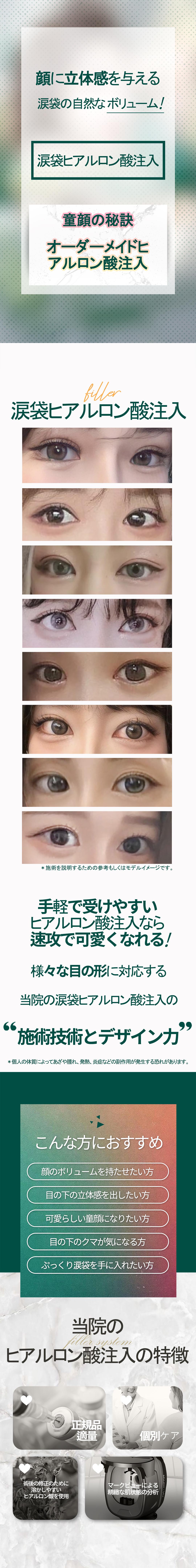 Tiêm Hyaluronic Acid túi lệ tạo chiều sâu tự nhiên | Điều trị tùy chỉnh từ 14.615 yên | Phòng khám Phẫu thuật Thẩm mỹ Pixel Lab