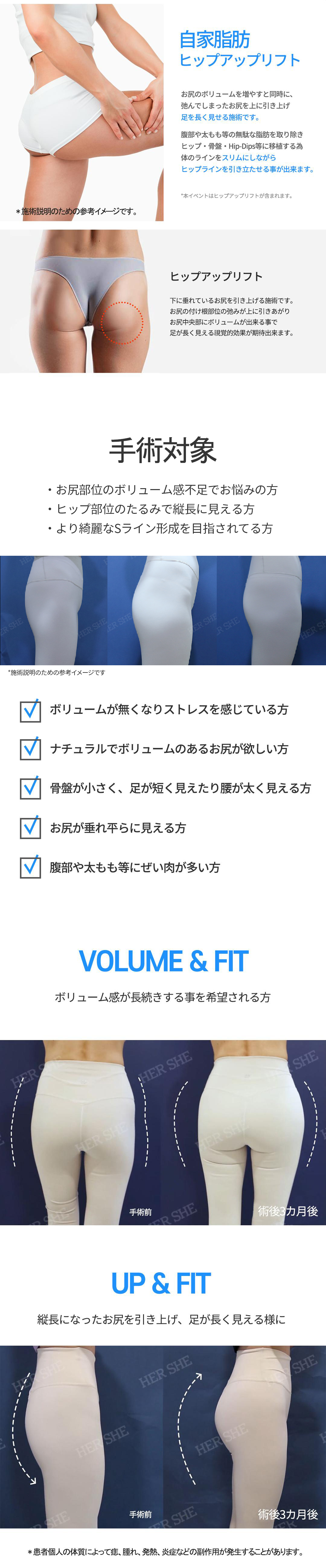 Nâng mông bằng mỡ tự thân｜Tạo S-line lý tưởng bằng hút mỡ × chỉ Epiticon｜Seoul Cheongdam HERSHE Plastic Surgery